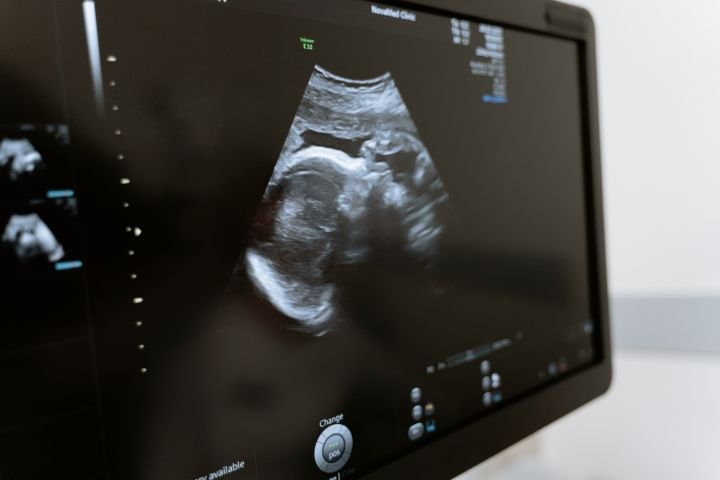 canine abdominal ultrasound